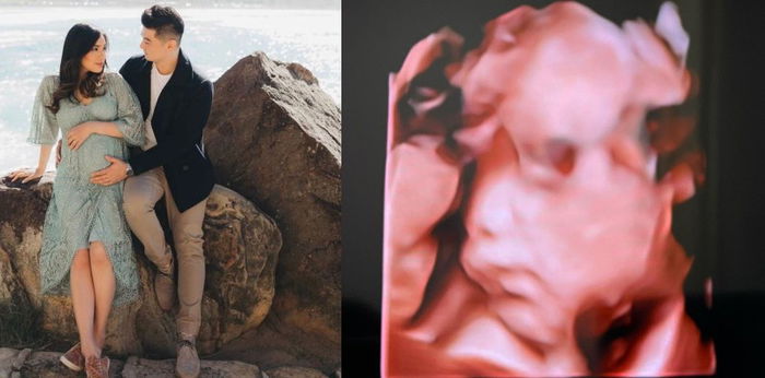 Selamat! Chef Arnold dan Istri Nantikan Kehadiran Anak Kedua