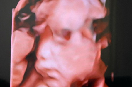 Istri Chef Arnold Hamil 