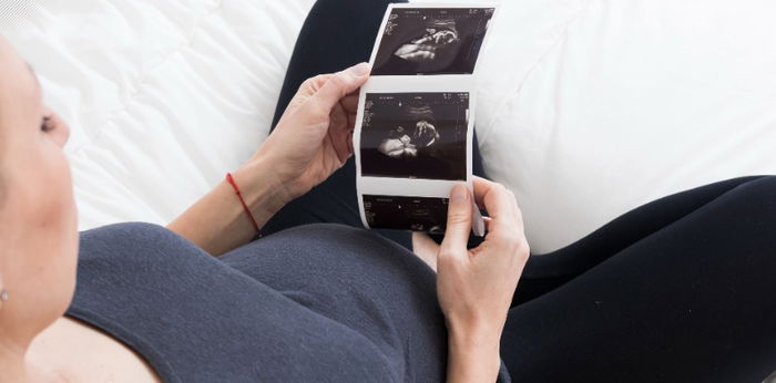 Sacrococcygeal Teratoma: Gejala, Penyebab, Faktor Risiko, Penanganan dan Pencegahan