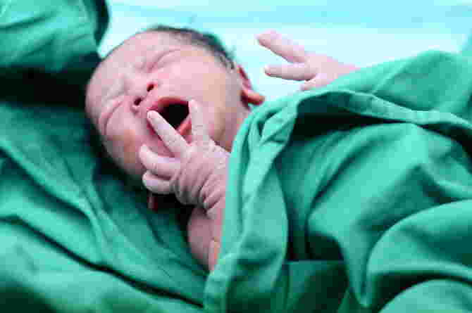 PDA Is Patent Ductus Arteriosus, Know the Symptoms and Causes