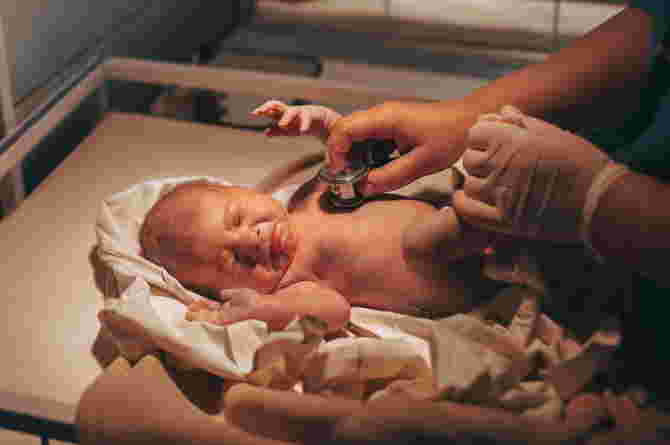 pda adalah patent ductus anteriosus