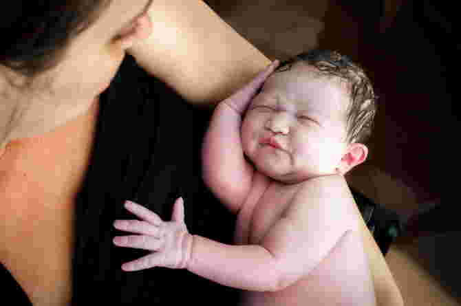 Potter Syndrome: Diagnosis, Symptoms, Causes, and Treatment