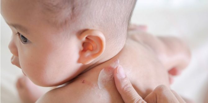 9 Rekomendasi Lotion Anti Nyamuk Anak dan Bayi di 2024, Cek!