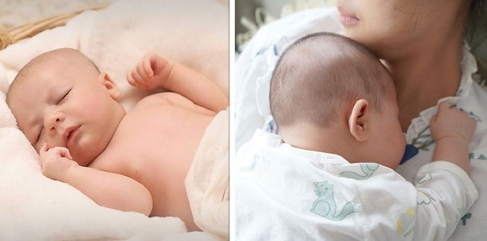 5 Cara Menurunkan Kuning Bayi dengan Cepat, Cek di Sini!