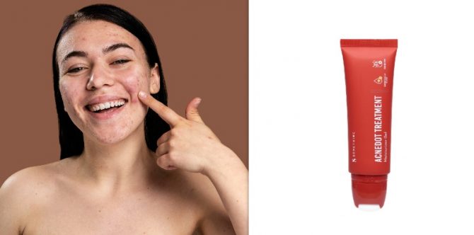 10 Krim Penghilang Bekas Jerawat di 2025, Mulus dan Flawless