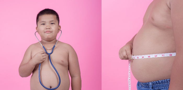 6 Fakta dan Pertanyaan Seputar Obesitas Anak, Ini Jawaban Dokter Parents!