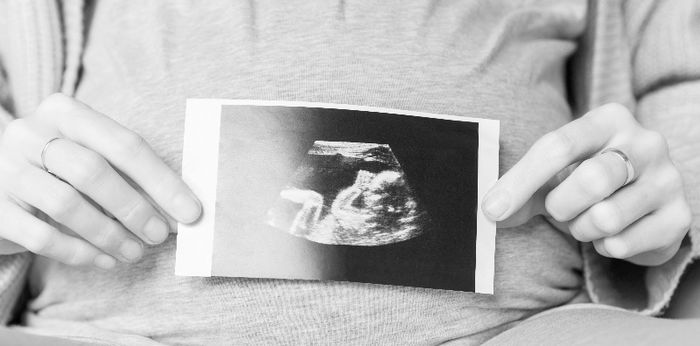 Sedih! Perempuan Ini Meninggal karena Janin Membatu, Begini Kronologinya