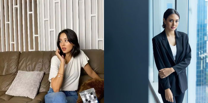 Cerita Aurelie Moeremans Sakit Tumor Colli: "Aku Jadi Susah Senyum"