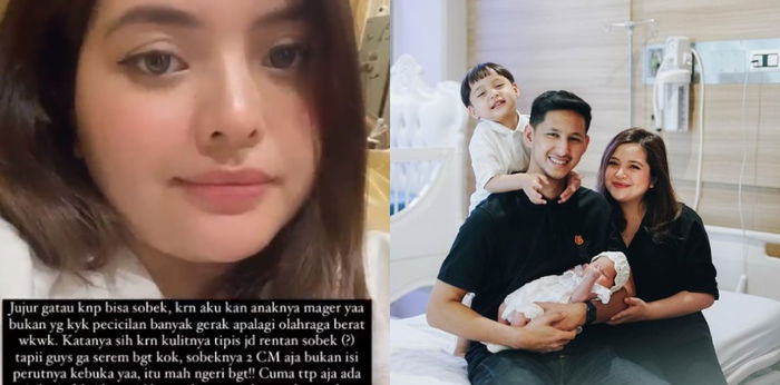 Jahitan Caesar Tasya Kamila Terbuka, Apa Faktor Penyebabnya?