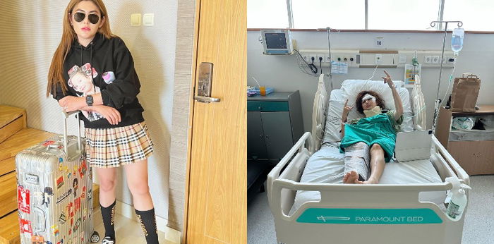 Artis Angela Lee Kecelakaan, Wajah Bengkak dan Kaki Dipasang Pen