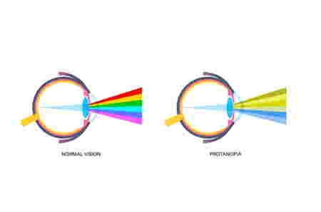 Contoh gambar tes buta warna