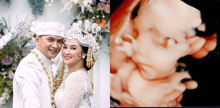 Istri Reiner Manopo Hamil Anak Pertama, Baby Bump Bikin Gemas