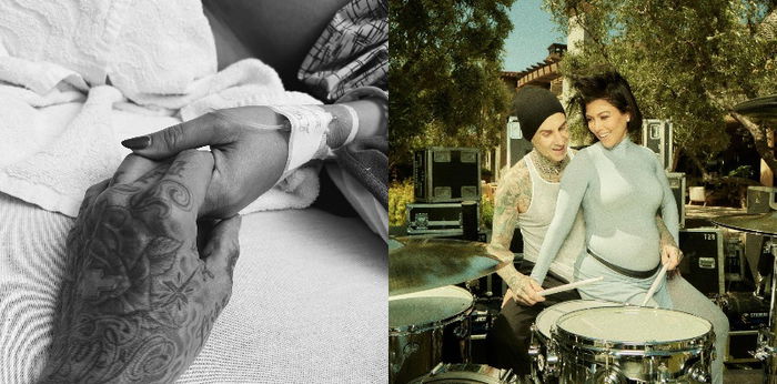 Kondisi Kehamilan Kourtney Kardashian, Harus Jalani Operasi Darurat