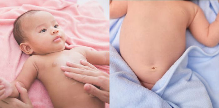 Arti Perubahan Warna Kulit pada Bayi, Ini Gejala yang Perlu Diwaspadai