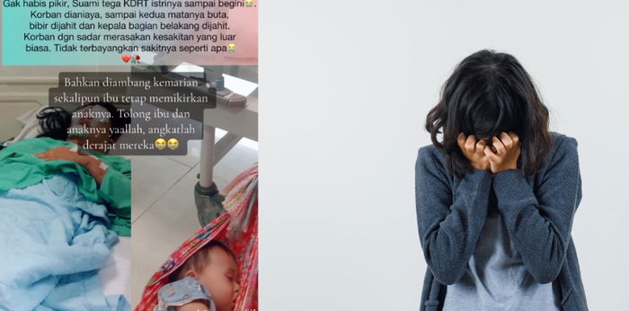 4 Fakta Kisah Tragis Ibu Korban KDRT di Bangka, Kedua Mata Buta Hingga Tak Bisa Kasih ASI untuk Bayinya