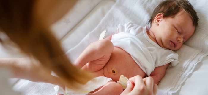 Cara Merawat Tali Pusar Bayi Melalui Pemilihan Popok yang Tepat