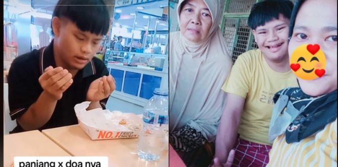Bikin Haru! Kisah Arby, Anak Down Syndrome yang Setia Jaga Ibu Sendirian di RS