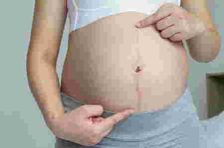 Ciri-ciri hamil 5 bulan yang sehat