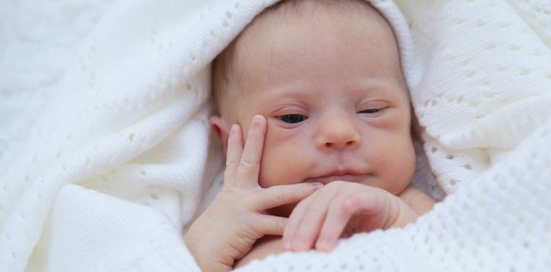 Penyakit Down Syndrome pada Bayi, Kenali Penyebab dan Gejalanya