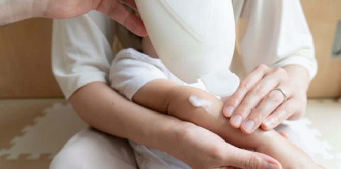 Rekomendasi 10 Salep Gatal Berbahan Alami untuk Bayi yang Aman