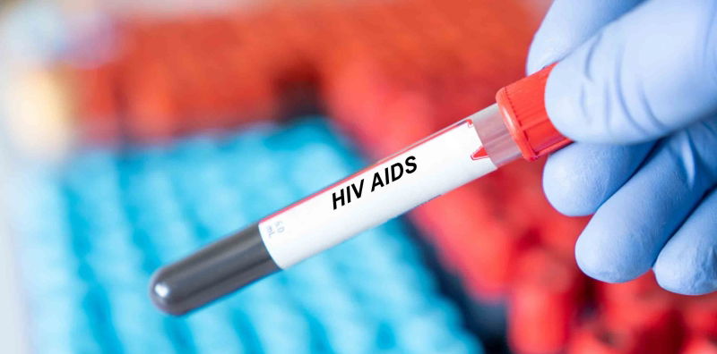 Kenali Perbedaan HIV dan AIDS, Gejala Awal hingga Cara Mengatasinya