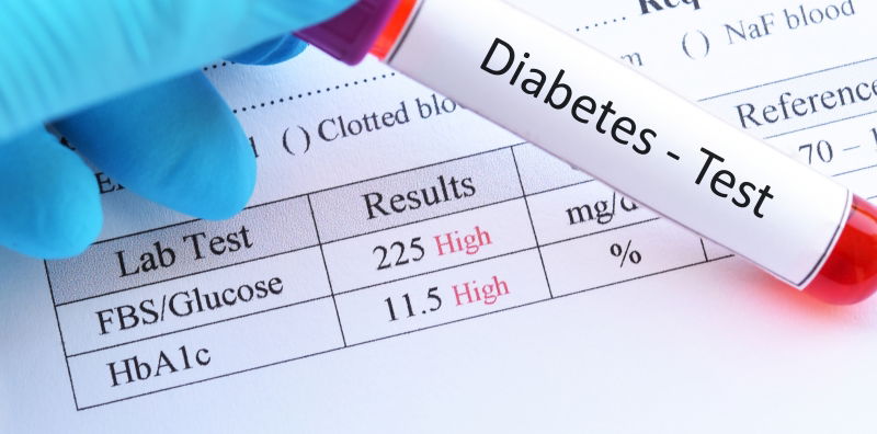 Waspada! Ini Ciri-ciri dan Gejala Awal Diabetes yang Sering Tak Disadari