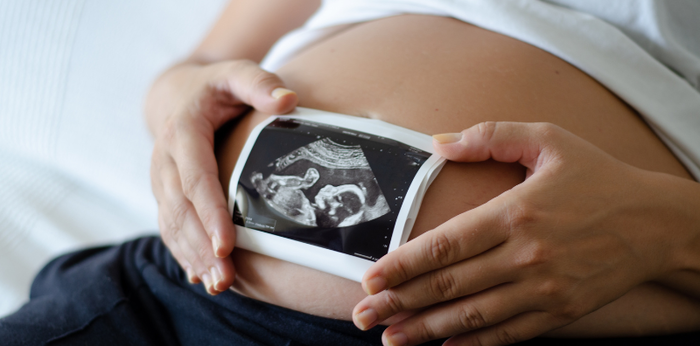 Adakah Perbedaan Gerakan Janin Laki-laki dan Perempuan? Ini Ulasannya, Parents