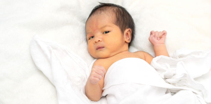 Sebabkan Kulit Kuning, Ini Ciri-ciri Bilirubin Tinggi pada Bayi dan Cara Mengeceknya