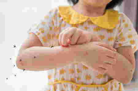 Ciri ciri DBD pada bayi