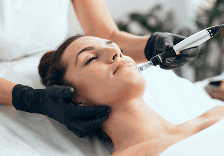 menghilangkan bekas jerawat hitam