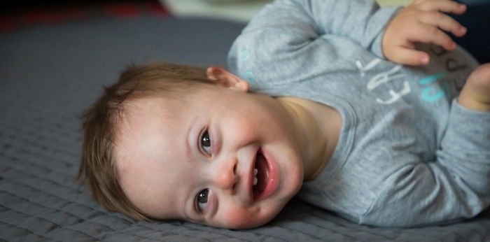 Berat Badan Bayi Down Syndrome dan Asupan Gizi Terbaik Untuknya