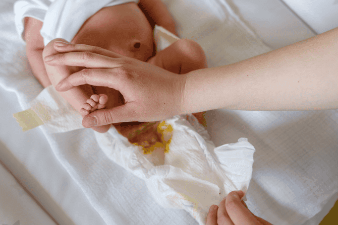 pup bercampur urine bayi