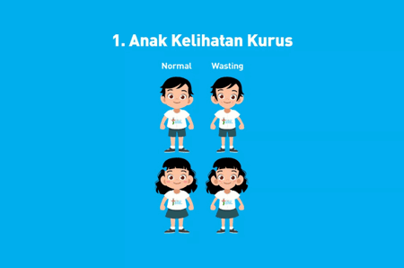 Ciri-Ciri Anak Gizi Buruk