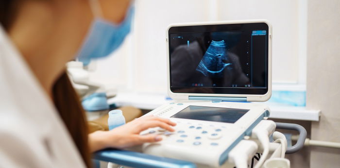 9 Tanda Hamil Bayi Down Syndrome dan Cara Mencegahnya