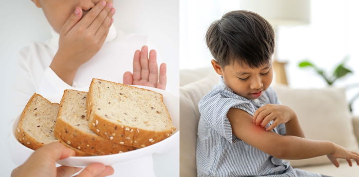 5 Ciri-ciri Alergi Gluten pada Anak, Parents Wajib Tahu!