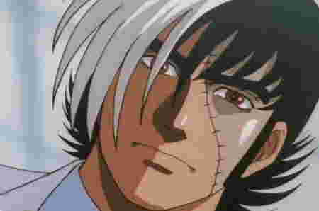 anime tema medis - Black Jack