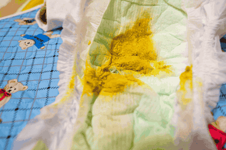 tekstur pup bayi 2 bulan