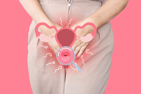 Keputihan abnormal berwarna kuning, abu-abu, atau hijau