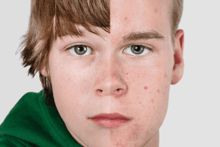 Bagaimana Perubahan Mental pada Anak Laki-Laki dan Perempuan yang Memasuki Masa Puber?