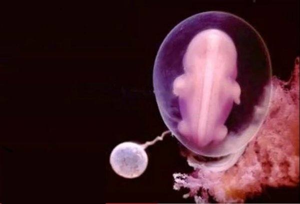 22 Foto Perkembangan Janin Dalam Rahim yang Luar Biasa