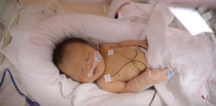 ห้องอภิบาลทารกแรกเกิดภาวะวิกฤต ( NICU ) คืออะไร ? เอาไว้ทำอะไรบ้าง ?