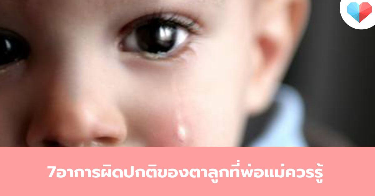 ลูกหยีตา หนังตาตก ตาเข 7 อาการผิดปกติของตาลูก ปัญหาไม่เล็กที่พ่อแม่ควรรู้