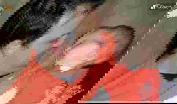 โรคหัวบาตร