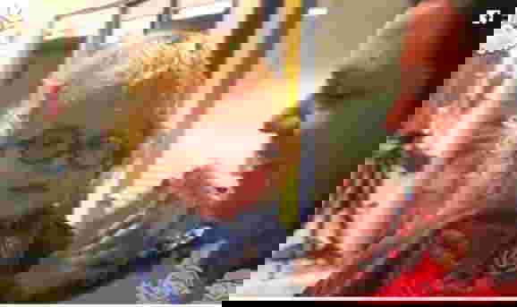 โรคหัวบาตร