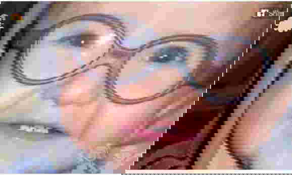 โรคหัวบาตร