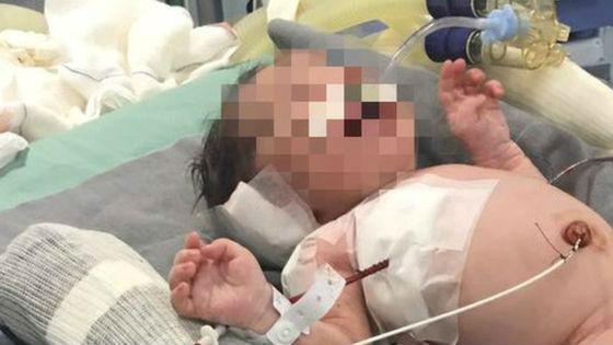 ปาฏิหาริย์!!! หนูน้อยดวงเเข็ง โดนยิงตั้งเเต่อยู่ในท้องเเม่ เเต่ก็รอดมาได้
