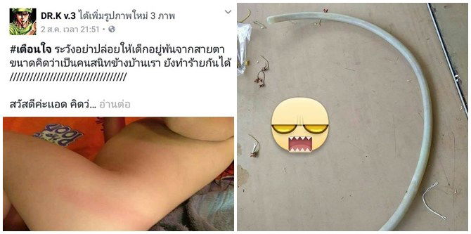 ป้าข้างบ้านใช้สายยางตีเด็กหมั่นเขี้ยวความน่ารัก จนเกิดรอยแดงบนตัวเด็กหญิงวัยขวบกว่า 