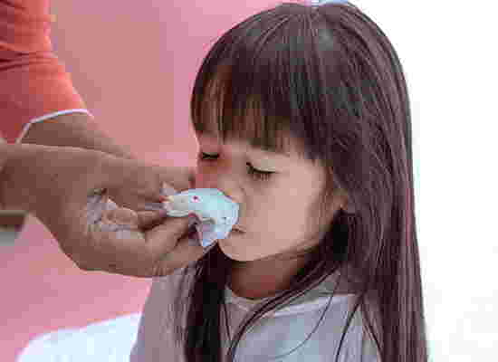 ลูกเลือดกำเดาไหล ทำไง