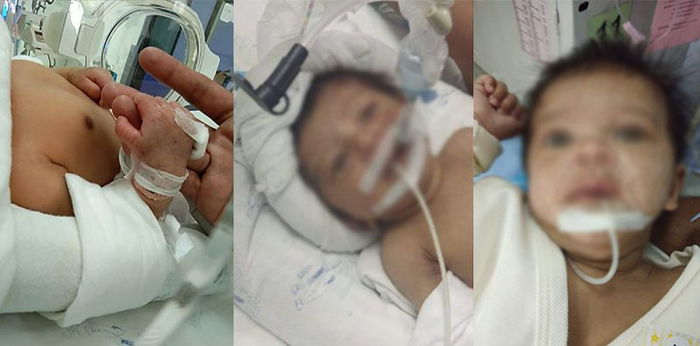 แม่แชร์ประสบการณ์ คลอดก่อนกำหนด ลูกสำลักน้ำคร่ำ ต้องใส่สายเครื่องช่วยหายใจ