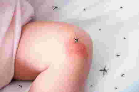 common rainy season illnesses